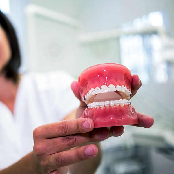 dental_smile_restauraciones