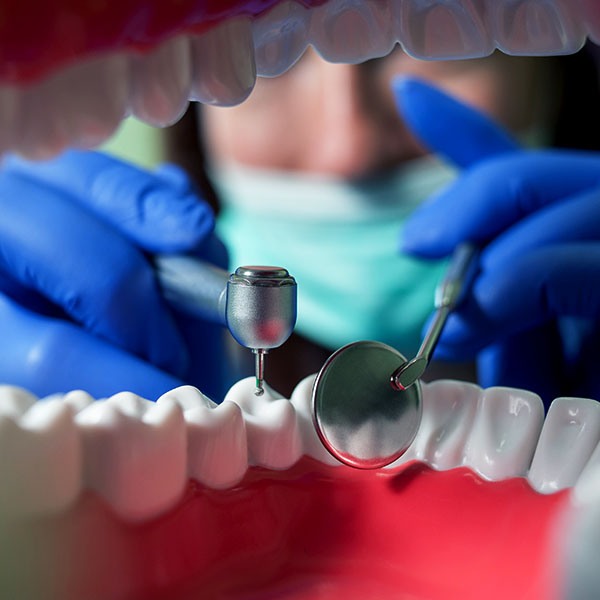 dental_smile_endodoncia