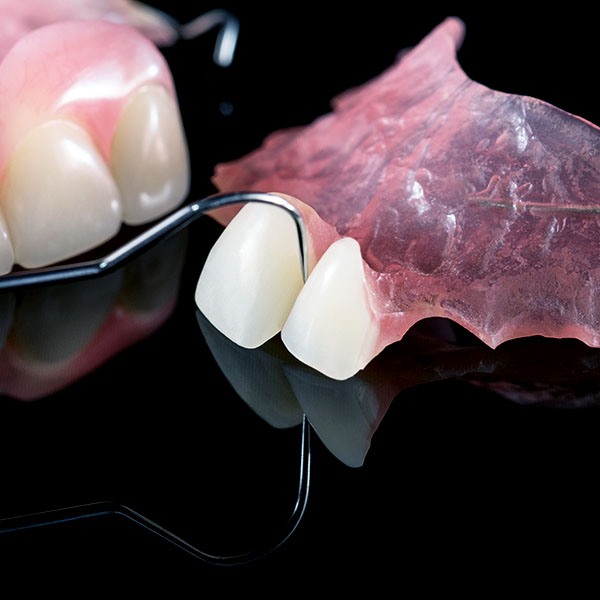 dental_smile_prótesis